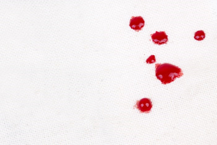 cleaning blood stains